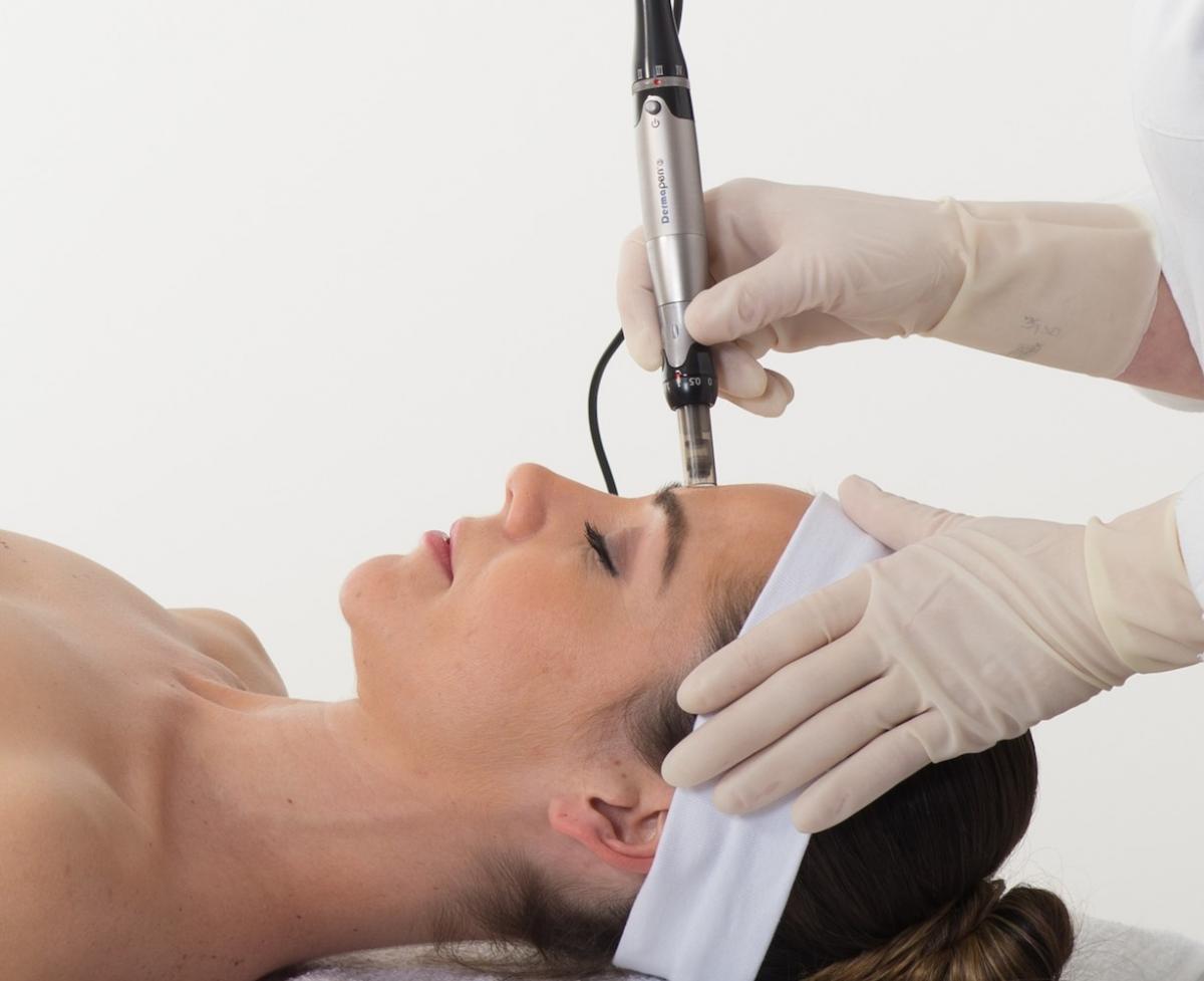 What is Dermapen